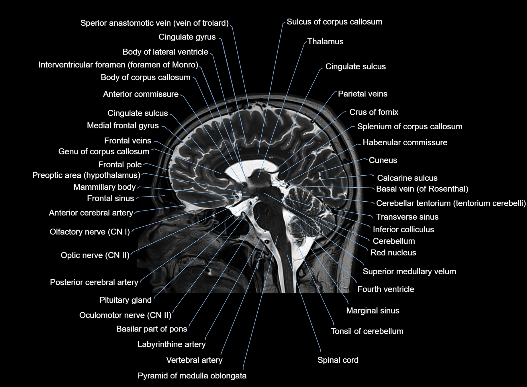 brain sagittal anatomy 3T MRI images -img-00001-00036.webp